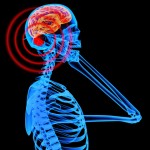 Mobile_Radiation_Brain